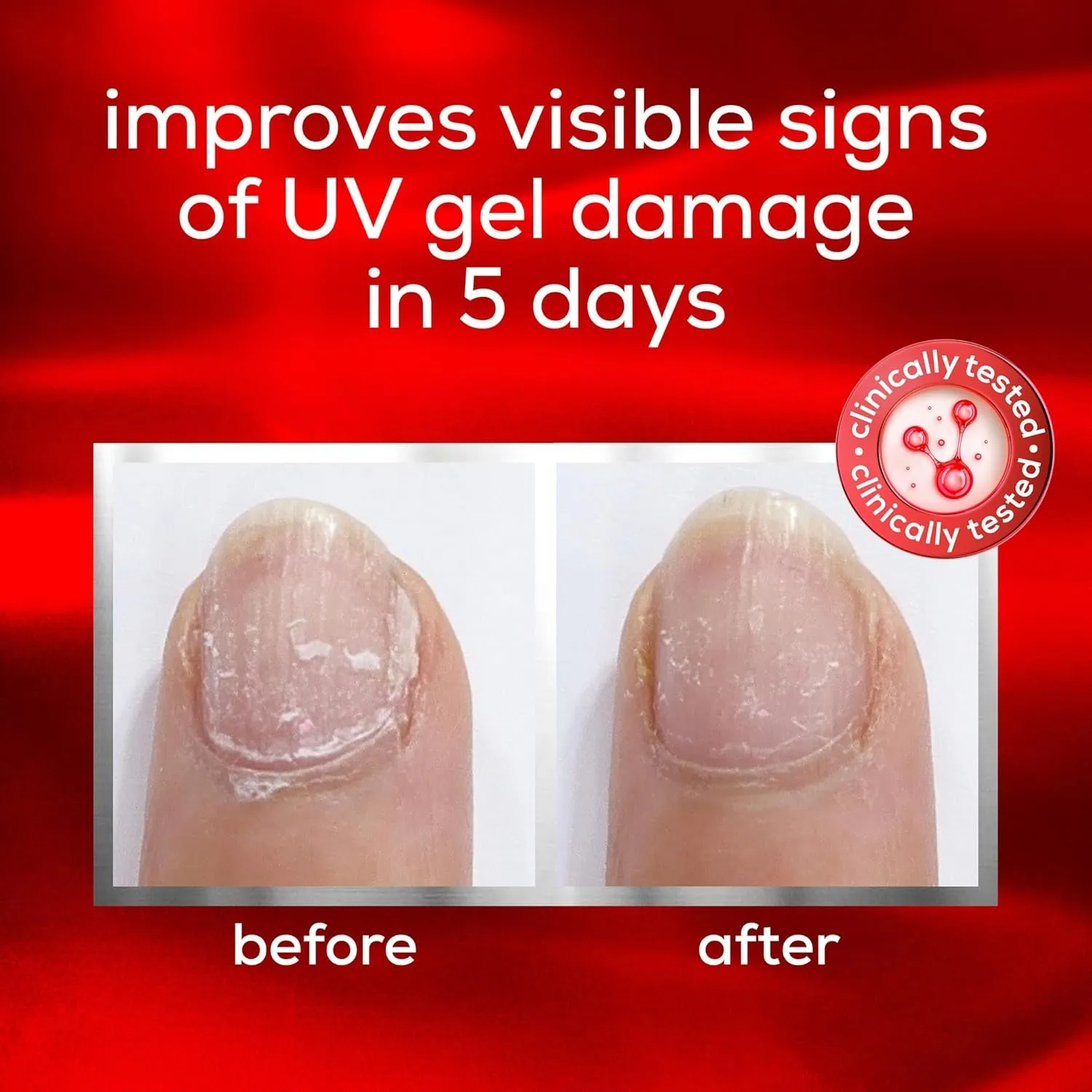 Nail Care, UV Gel Damage Repair Treatment, to the Rescue Nail Repair Base Coat, 0.46 Fl Oz